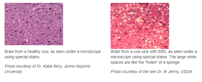 Bovine Spongiform Encephalopathy